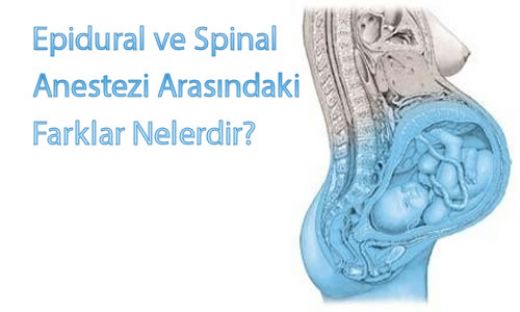 Epidural Ve Spinal Anestezi